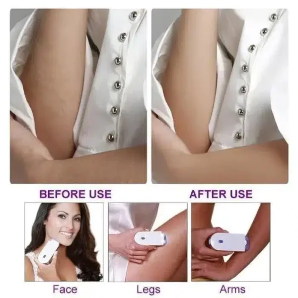 Silky Smooth Hair Eraser - Image 12